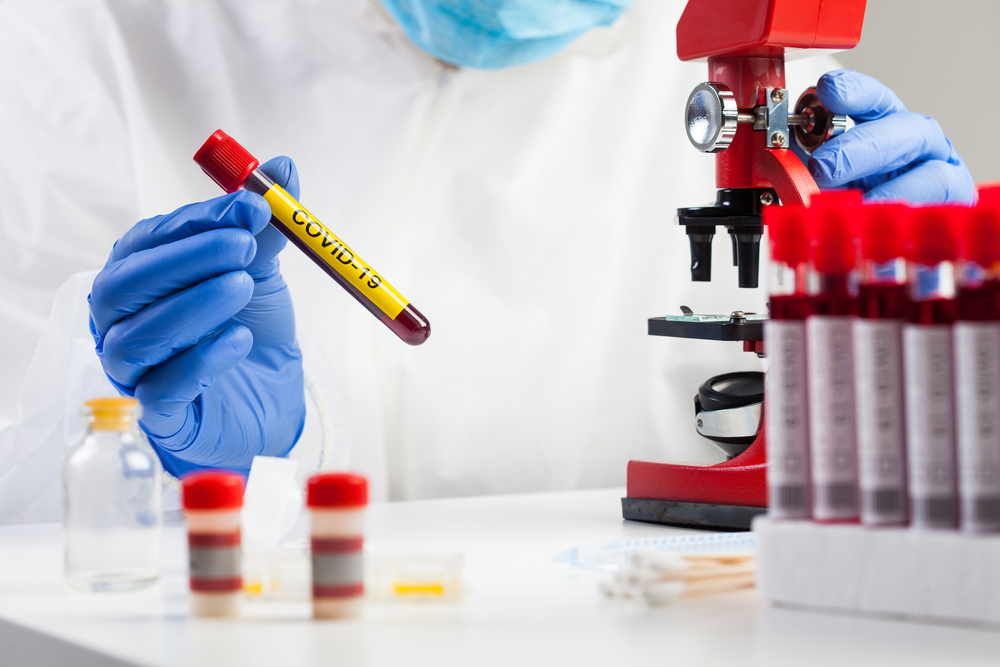 Convalescent Plasma Therapy: A Treatment For COVID-19