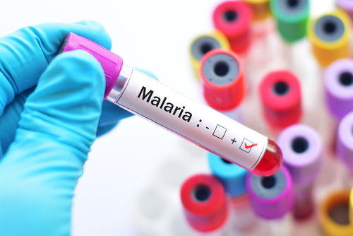 Malaria menace: Malaria can be life-threatening during COVID-19