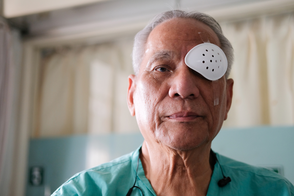 The history of progress and innovation in cataract surgery